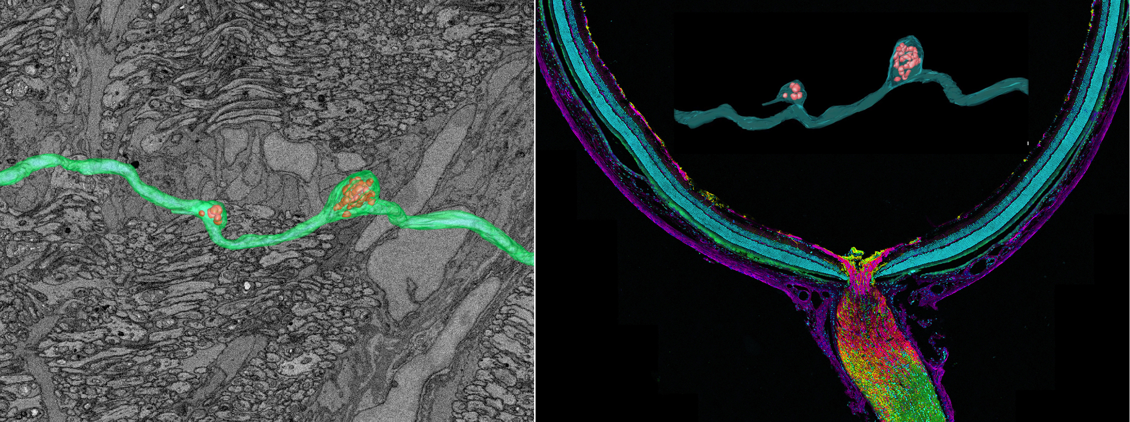Transcellular mitophagy